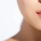 ボトックス